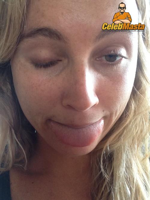 Alana Blanchard