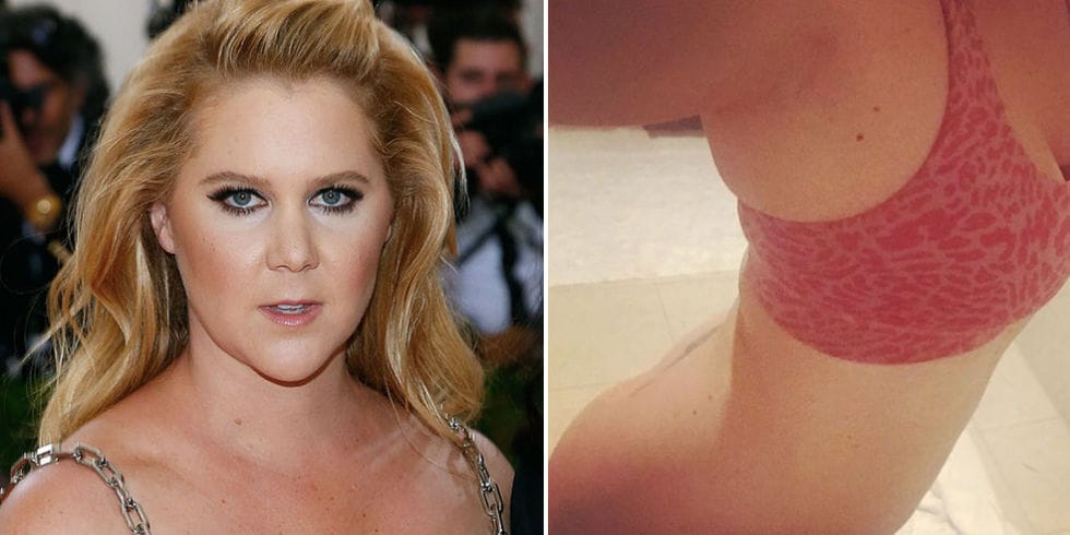 Amy Schumer