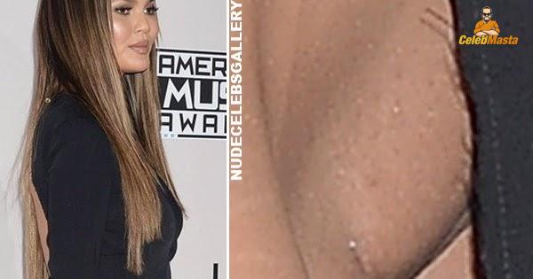 Chrissy Teigen
