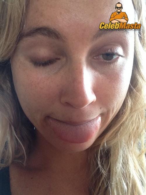 Alana Blanchard