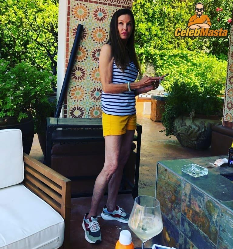 Janice Dickinson