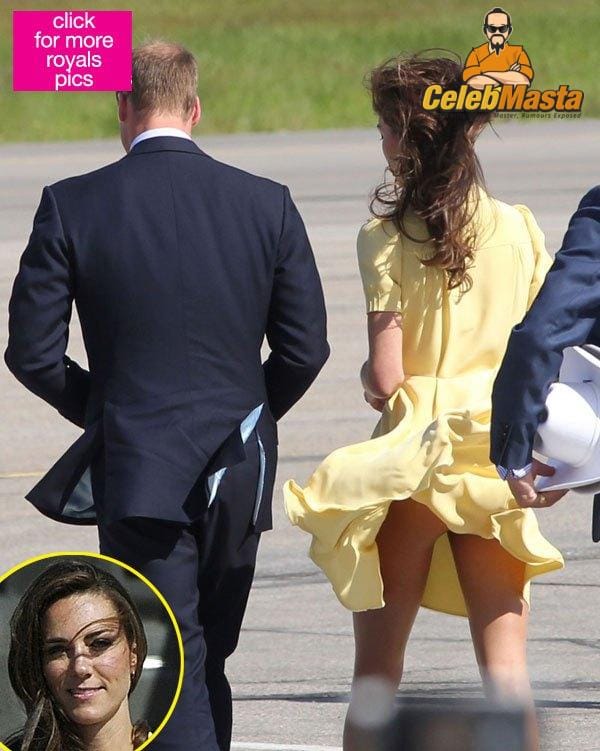 Kate Middleton